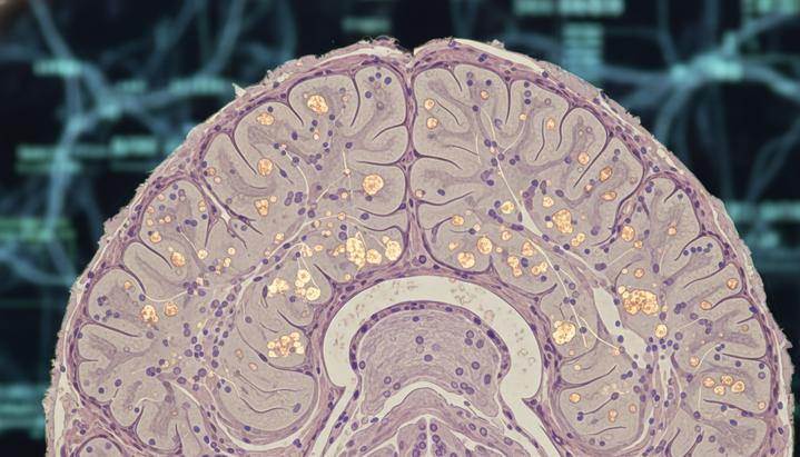 Микроскопическое изображение участка мозга с видимыми воспалительными маркерами в области гипоталамуса.