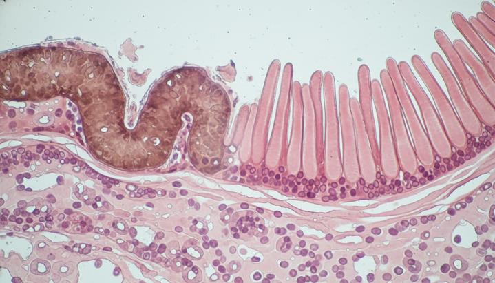 Клеточная терапия CAR-T ускоряет регенерацию кишечника Микроскопический вид слизистой оболочки кишечника: участок с поврежденными ворсинками переходит в здоровый и восстановленный.
