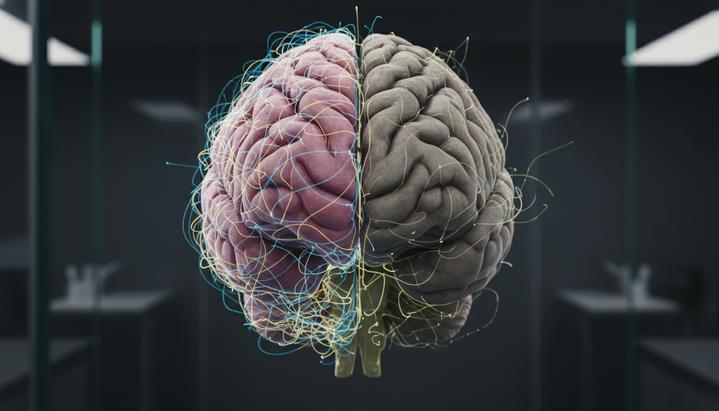 Трехмерная модель человеческого мозга: сравнение здоровой половины и половины с признаками возрастной атрофии.