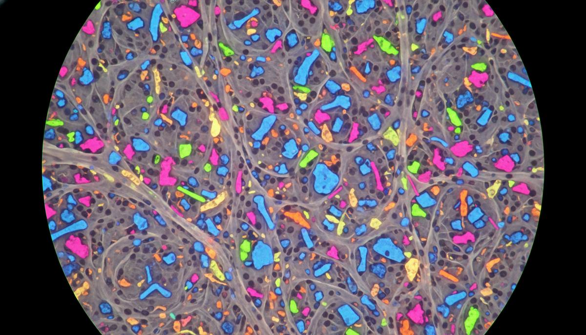Микроскопическое изображение: скопление светящихся разноцветных частиц микропластика в биологической ткани организма.