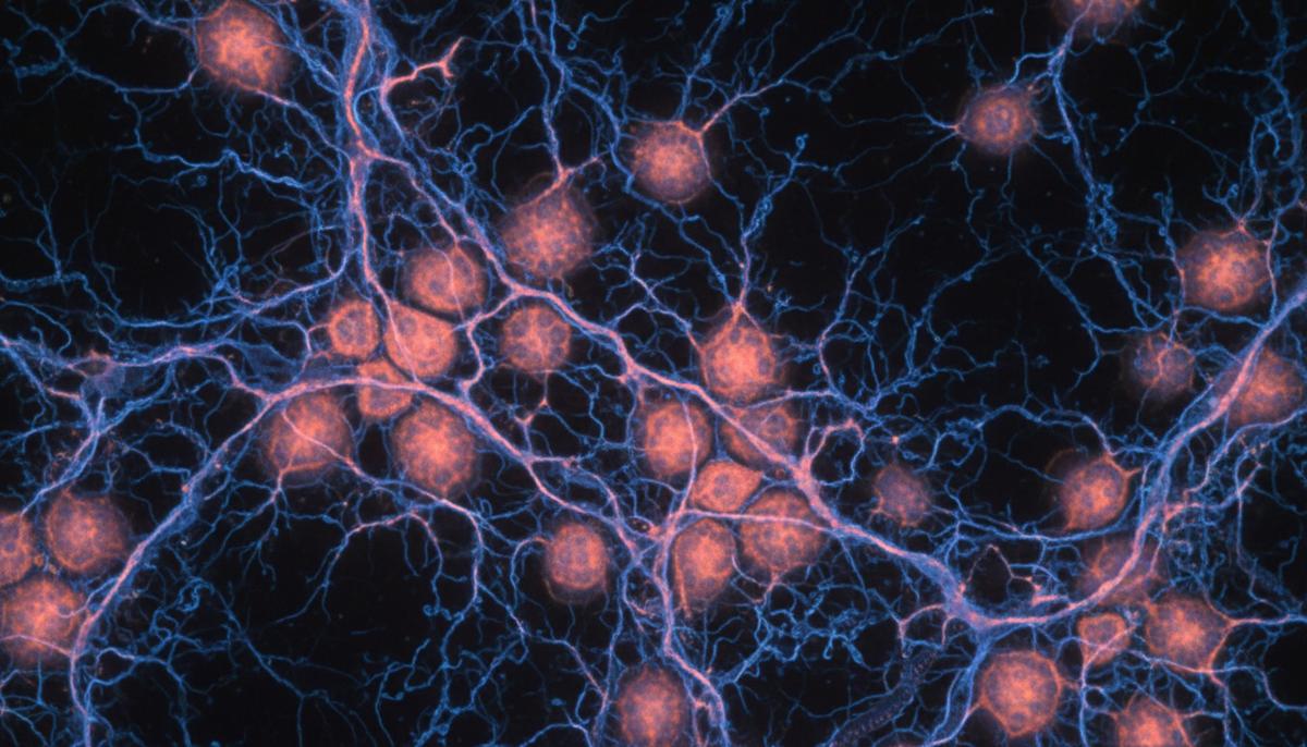 Микроскопическое изображение астроцитов и нейронов в мозге. Звездообразные клетки светятся, указывая на воспаление.