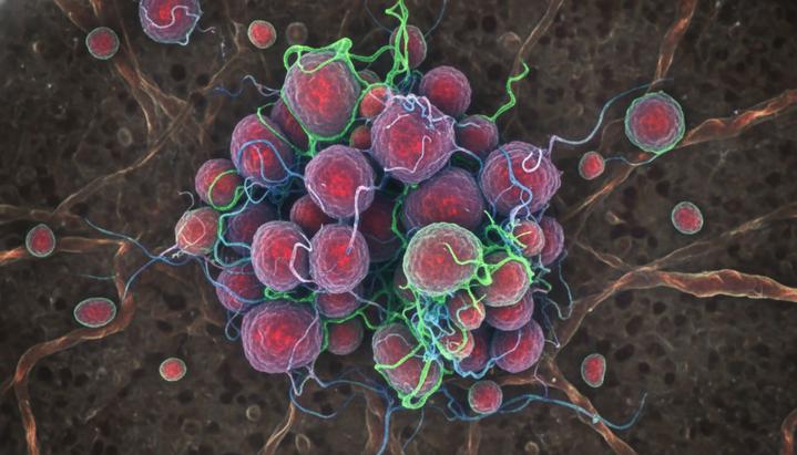 Число случаев рака в мире к 2050 году вырастет на 61%