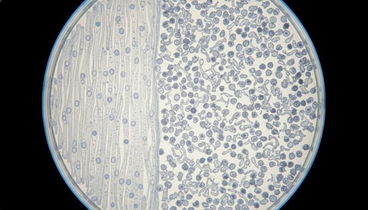 Ученые объяснили двойственную роль полиаминов в старении и раке