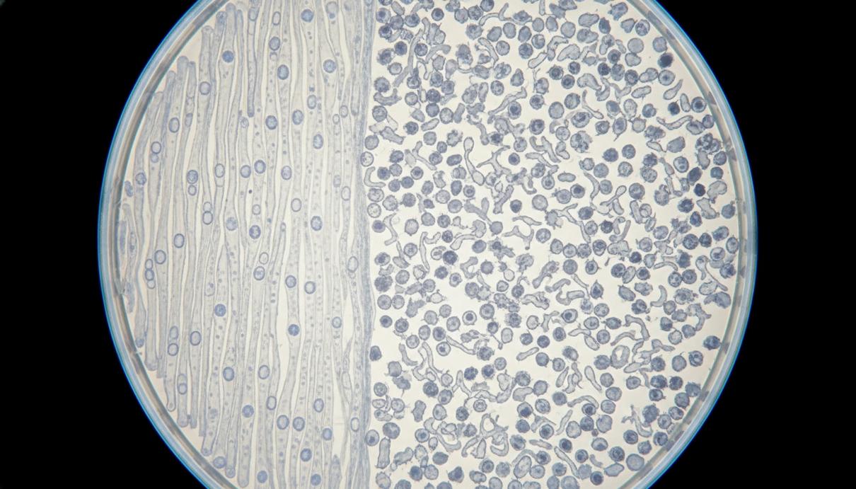 Чашка Петри под микроскопом с двумя культурами клеток: на одной стороне здоровые клетки, на другой – злокачественные раковые клетки.