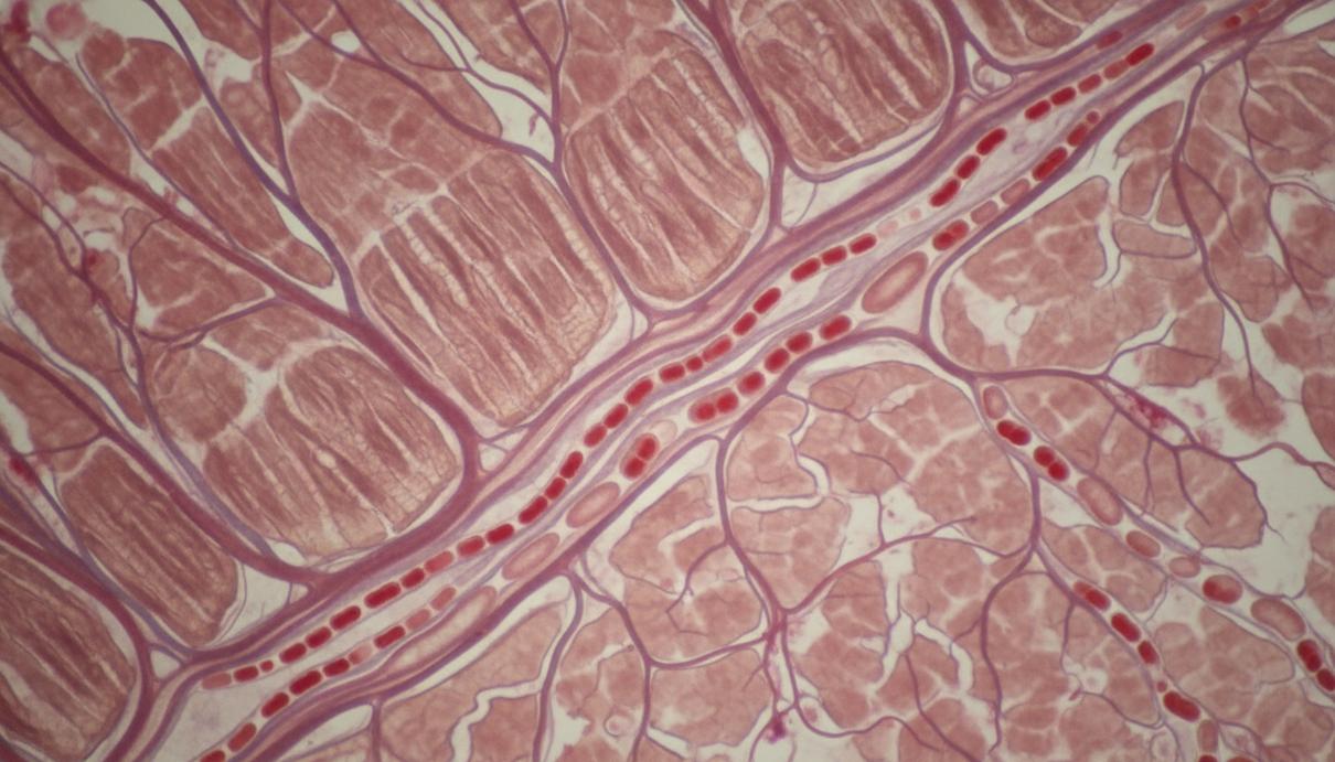 Сеть кровеносных капилляров в ткани сердечной мышцы под микроскопом, эритроциты возобновляют движение.
