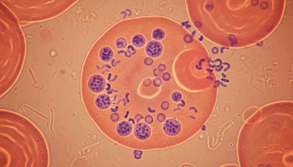 Макрофотография малярийных паразитов Plasmodium внутри эритроцита, показывающая процесс их размножения.