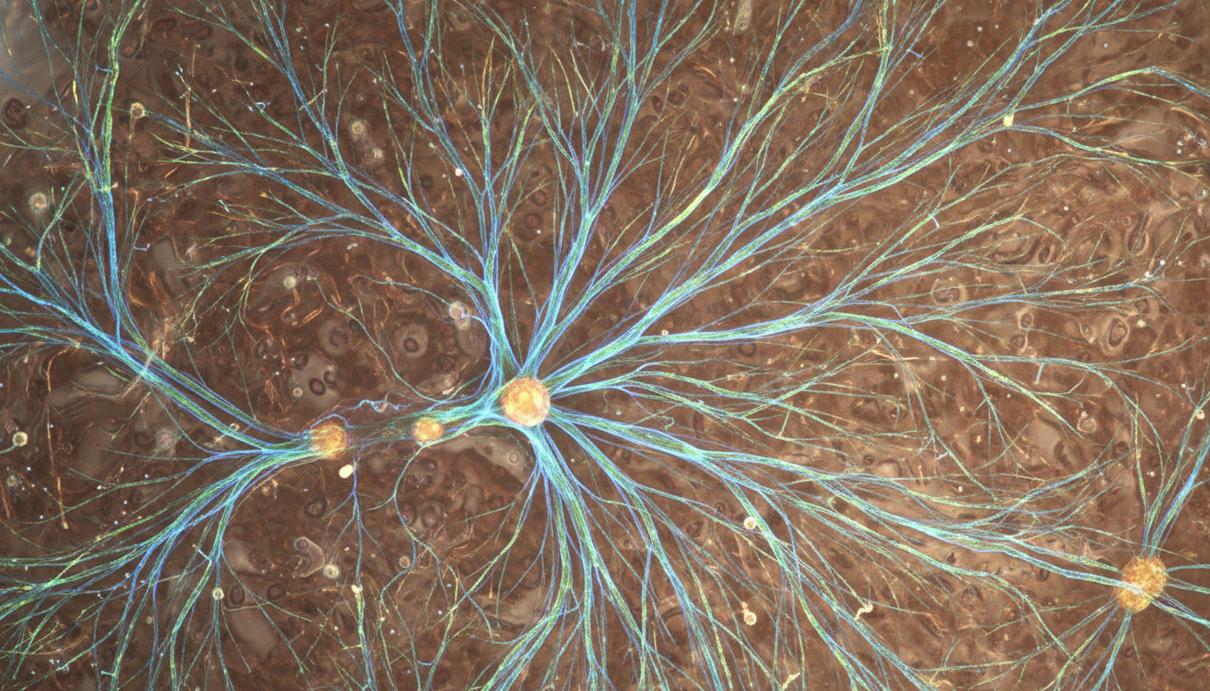 Микроскопическое изображение светящихся нейронных аксонов, прорастающих сквозь сложную клеточную структуру ткани головного мозга.