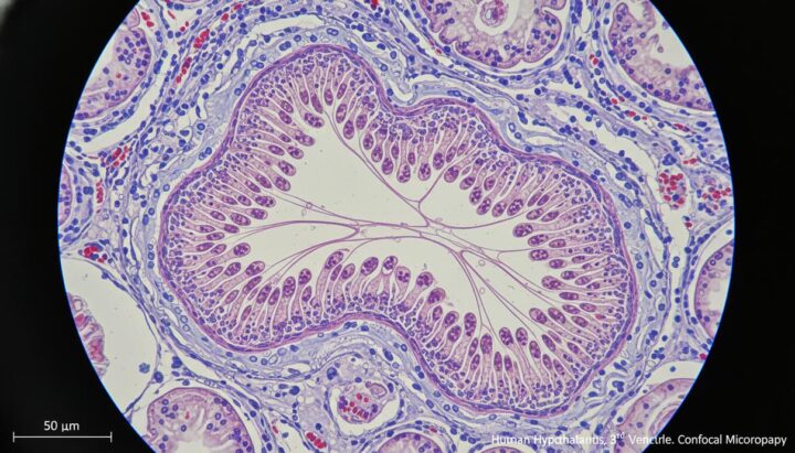 Ученые обнаружили механизм очистки мозга от вызывающих деменцию белков