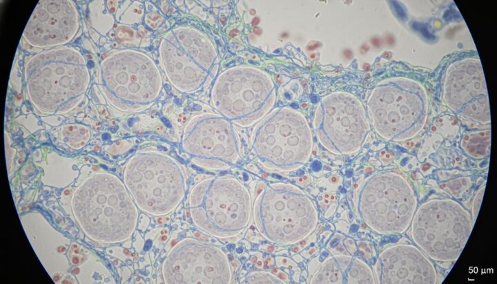 Биологи установили причину тяжелых осложнений при гриппе у пожилых людей