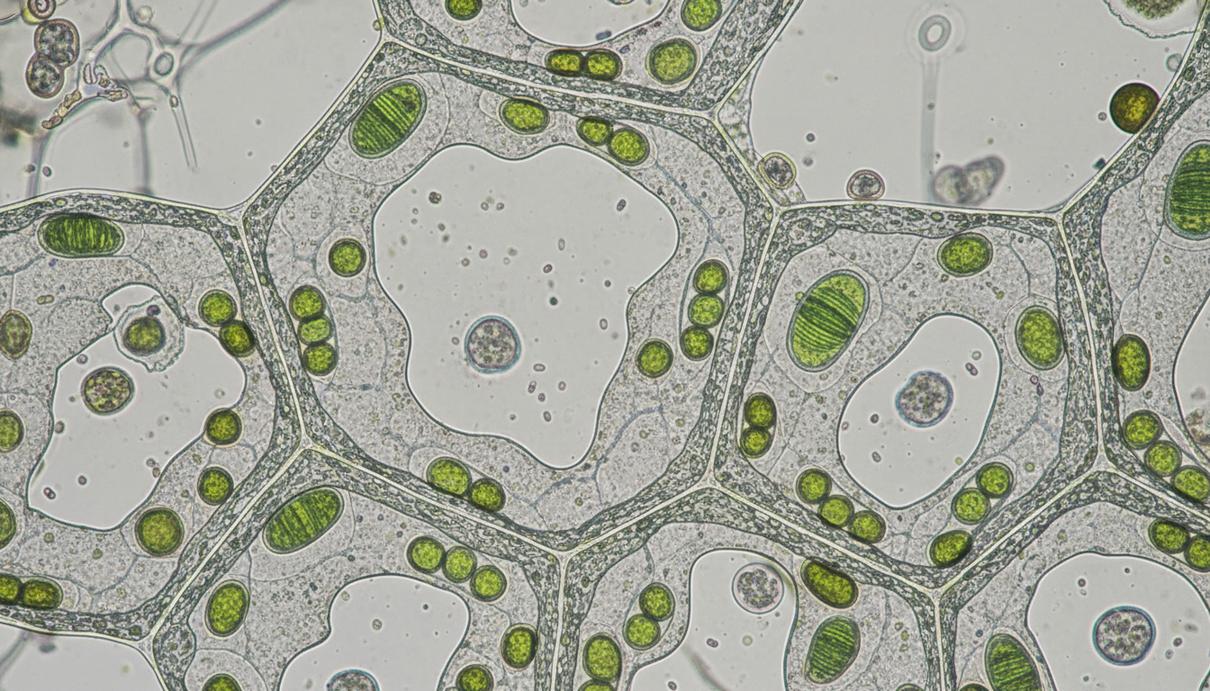 Растительные клетки под микроскопом с крупными прозрачными органеллами и видимыми клеточными стенками