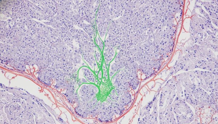 Пересадка стволовых клеток помогла восстановить мозг мышей после инсульта